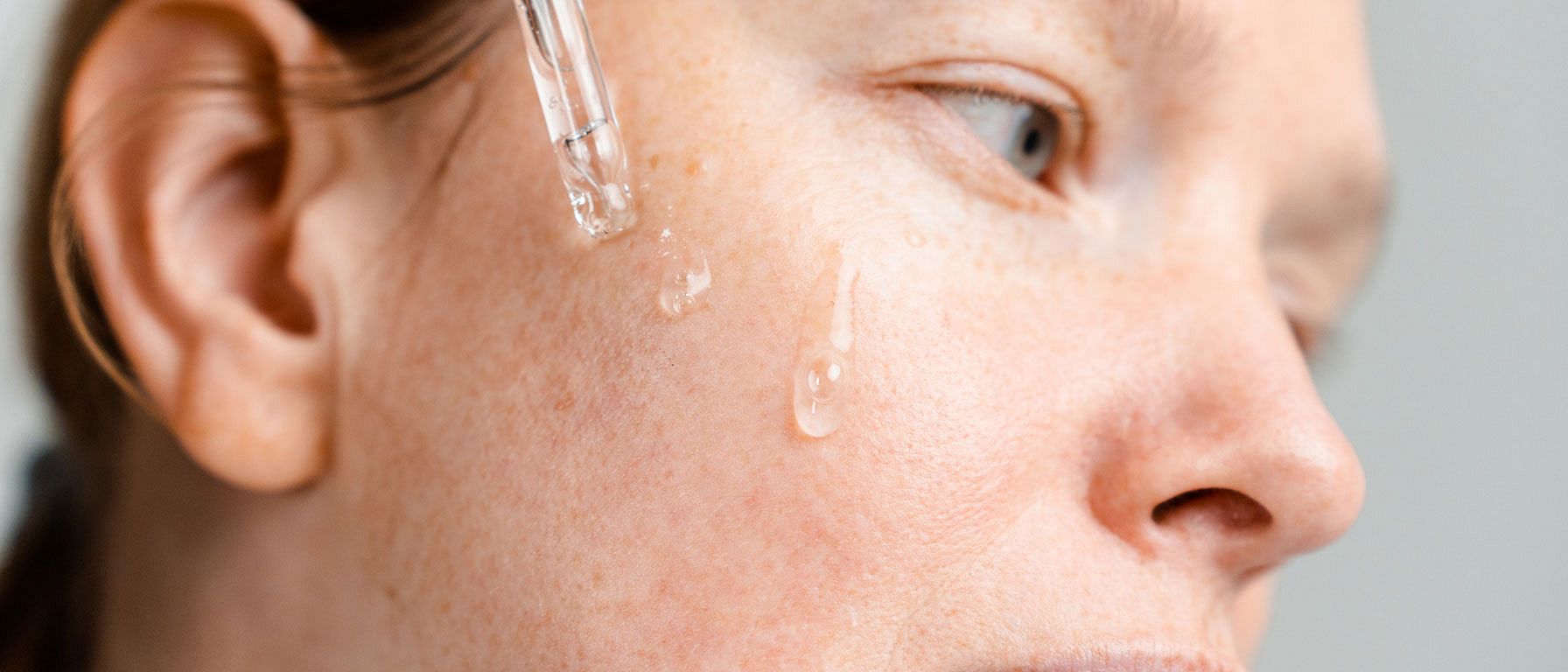 taches de pigmentation femme visage gentiane bleue