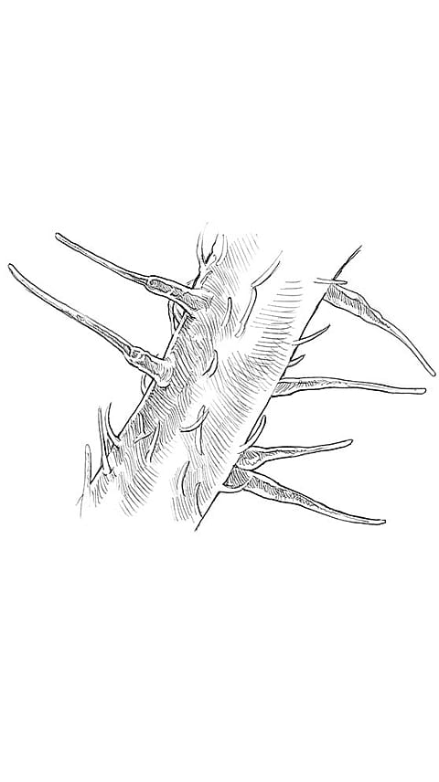 Poils urticants de la petite ortie