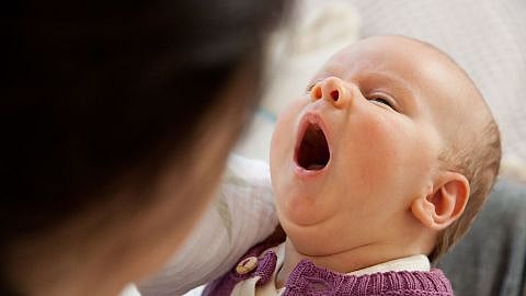 Les croûtes de lait chez le nourrisson : pourquoi ? que faire ? - Bébé M